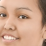 nat_skin_after